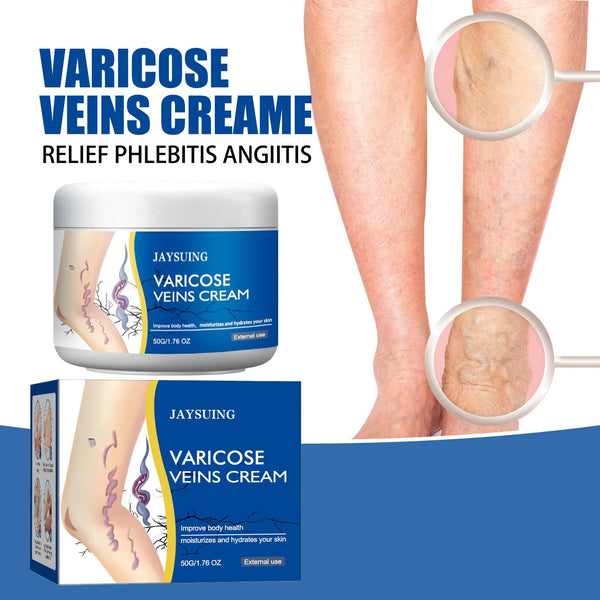 Jaysuing-Veins-Treatment-Creams-Soothing-Painness-Eliminate-Vasculitis-Phlebitis-Remove-Spider-Leg-Angiitis-Improvement-Ointment.jpg